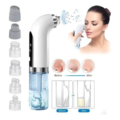 Seis Cabezales De Succión Removedor De Espinillas, Máquina De Limpieza De Poros Y Acné, Eléctrico Usb Savefree - $227.43 en Mercado Libre | PrecioMX